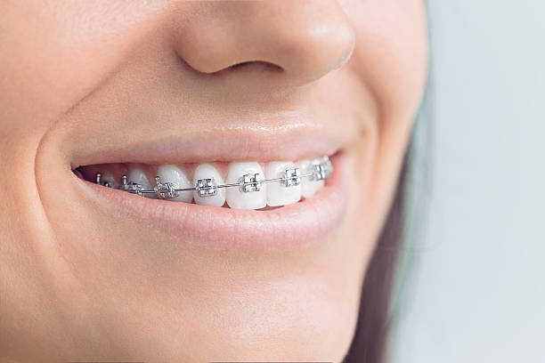 Full Mouth Reconstruction in Logan Elm Village, OH